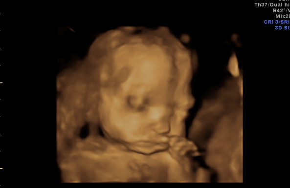 Leila's Ultrasound